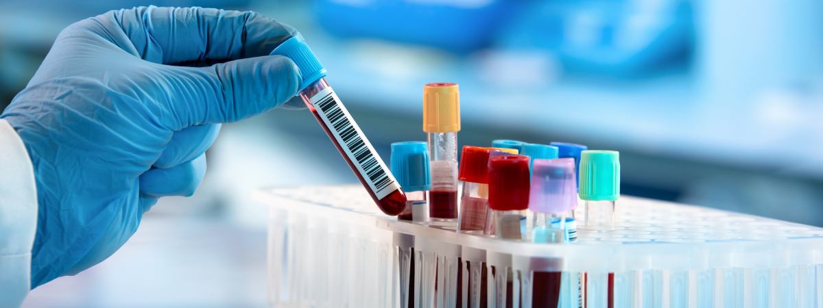 diagnostic-test-ekom diagnostic-test